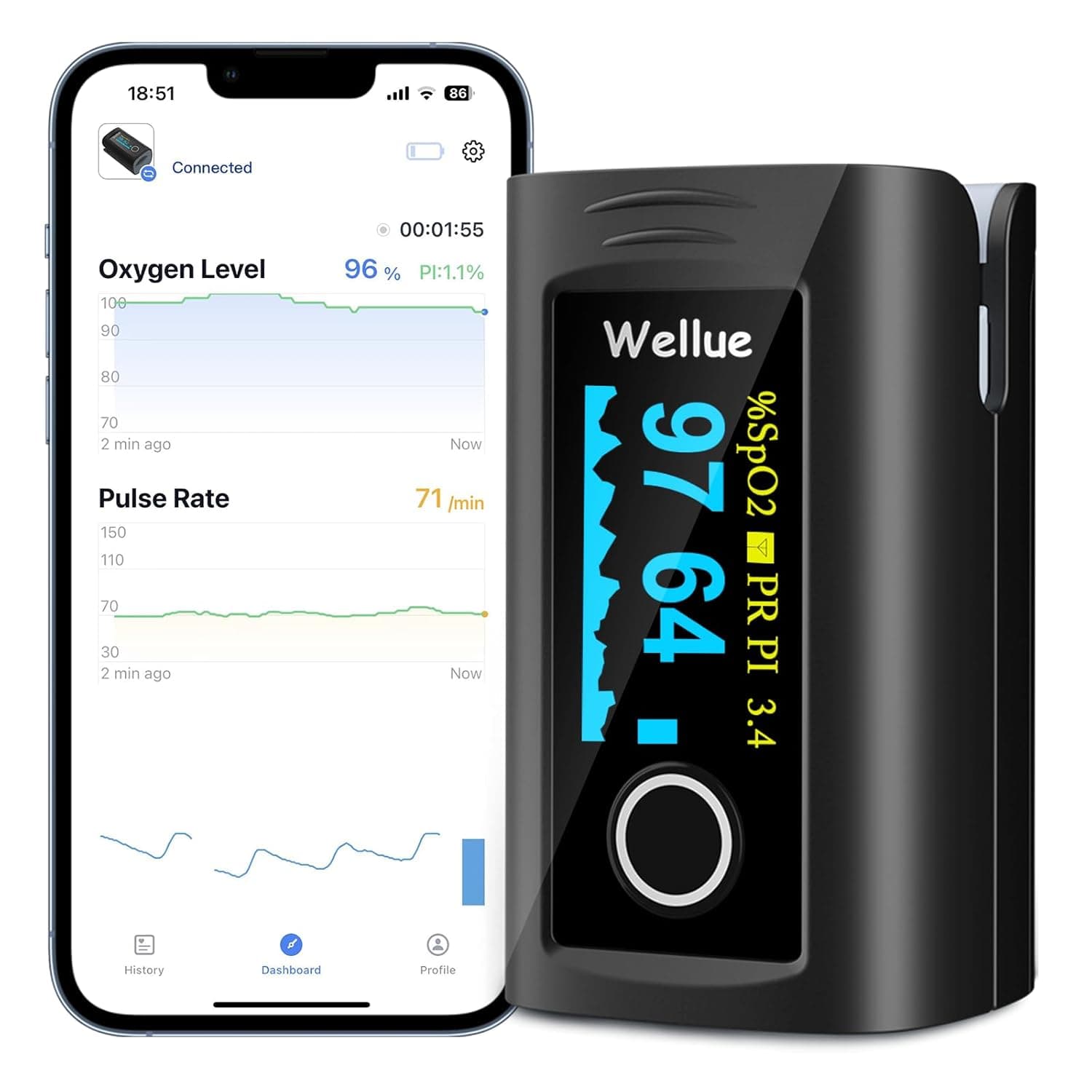 Wellue O2Ring Oxygen Monitor